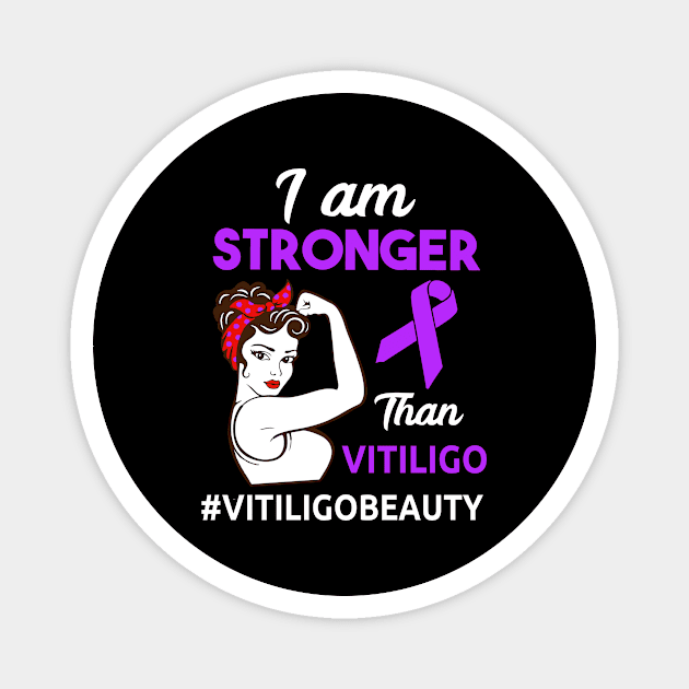 Vitiligo Awareness design Magnet by KuTees